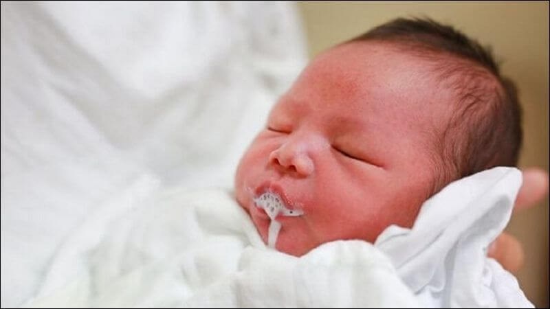 Trẻ có thể nôn trớ sữa từ mũi hoặc miệng khi bị trào ngược da dày thực quản Trẻ có thể nôn trớ sữa từ mũi hoặc miệng khi bị trào ngược da dày thực quản