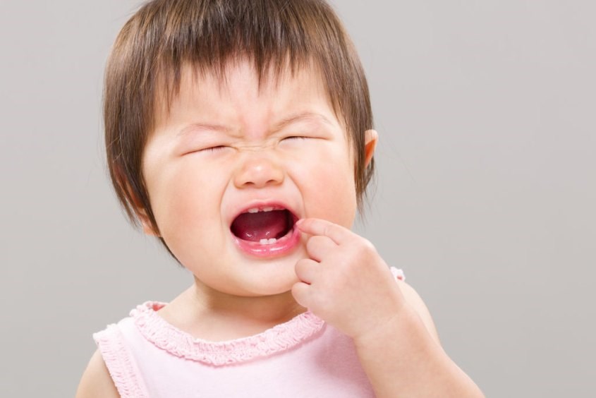 Răng sữa mọc lệch để lại hậu quả gì cho bé?