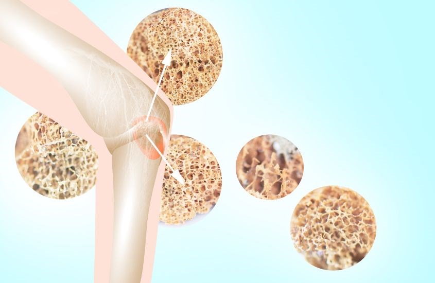 Vi chất có vai trò quan trọng trong việc phát triển xương Vi chất có vai trò quan trọng trong việc phát triển xương