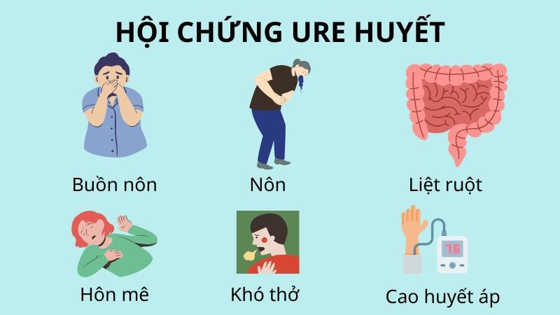 Hội Chứng Ure Máu: Tổng Quan và Những Điều Cần Biết