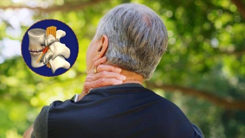 Thoái hóa đốt sống cổ là bệnh lý đặc trưng bởi sự biến đổi của đĩa đệm đốt sống
