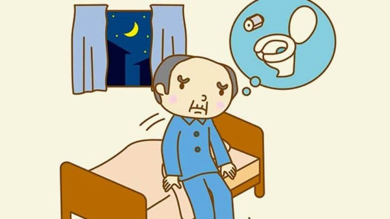 Tiểu đêm nhiều lần là tình trạng người bệnh thức dậy trên 2 lần/đêm để đi tiểu