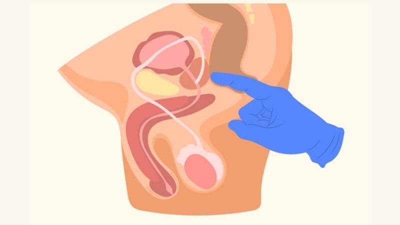 Thăm trực tràng giúp bác sĩ phát hiện nguyên nhân gây tiểu rắt