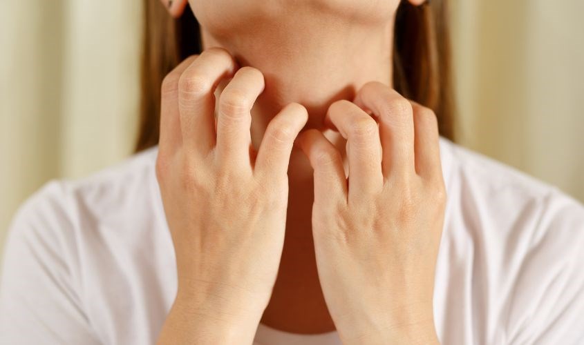 Làm dịu nấm da ở cổ