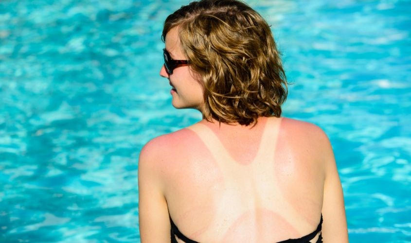 Làm tái sinh mô và tái tạo da bị hư hại dưới ánh nắng mặt trời