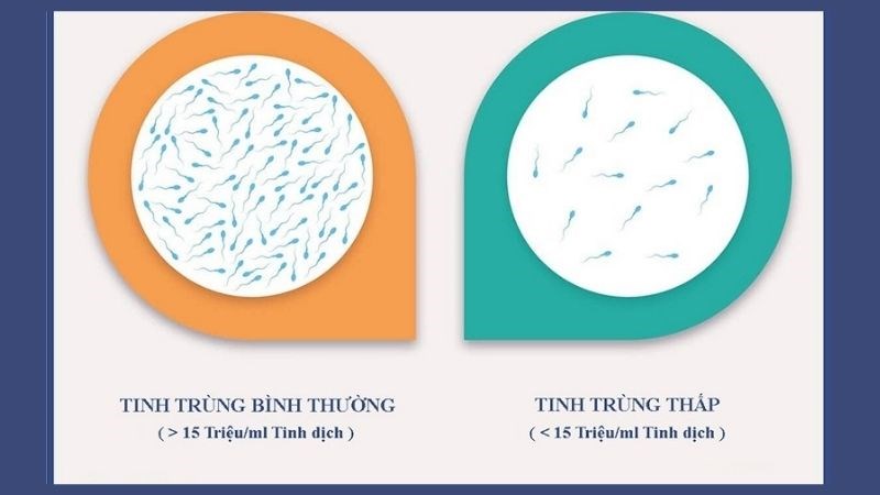 Số lượng tinh trùng thấp khi ít hơn 15 triệu con/ml Số lượng tinh trùng thấp khi ít hơn 15 triệu con/ml