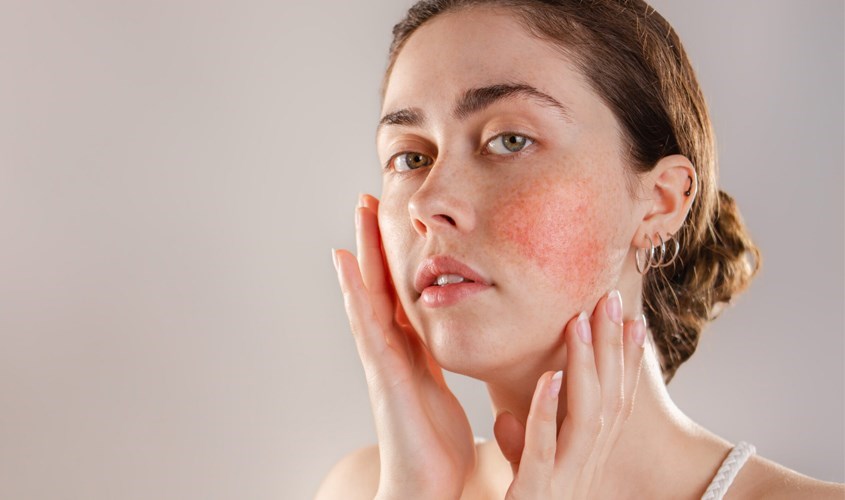 Cần lựa chọn serum vitamin C có thành phần lành tính, an toàn cho da nhạy cảm