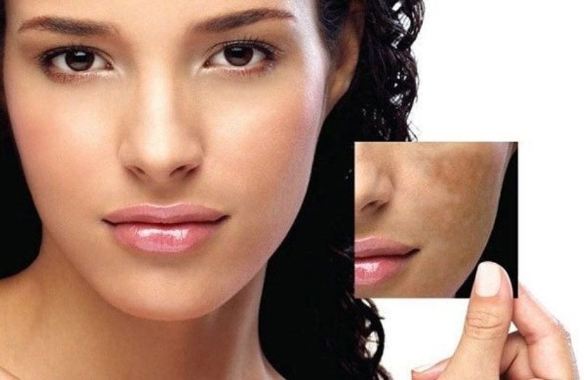 Skincare hợp lý để cải thiện màu da