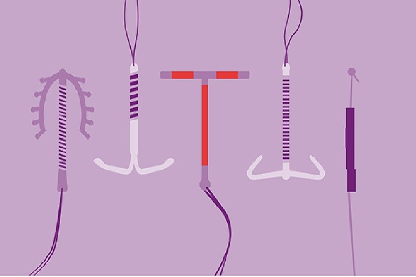 Que tránh thai sau sinh