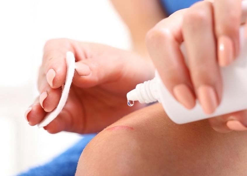 Vệ sinh vết thương là bước đặc biệt quan trọng trong sơ cứu trẻ bị chó cắn