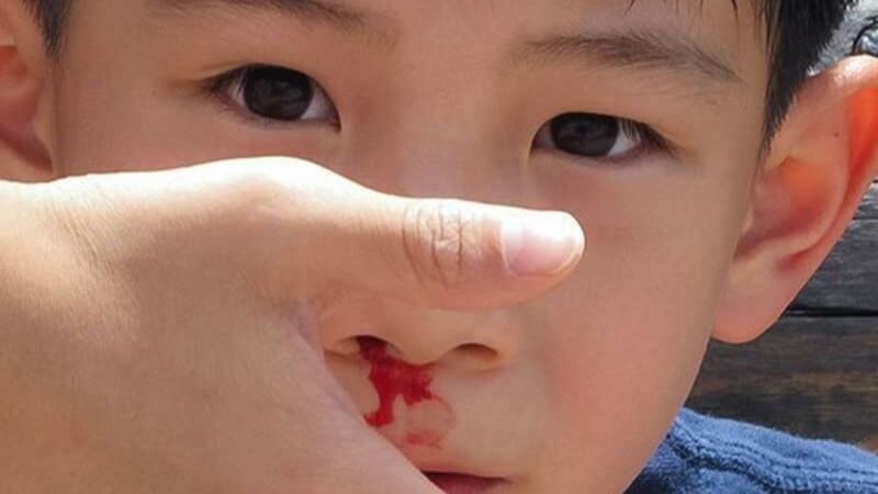 Lệch v&aacute;ch ngăn mũi c&oacute; thể g&acirc;y ng&aacute;y khi trẻ thở