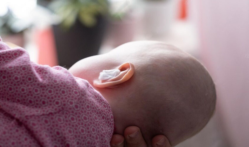 Cách phòng ngừa mất thính lực ở trẻ sơ sinh. Cách phòng ngừa mất thính lực ở trẻ sơ sinh.