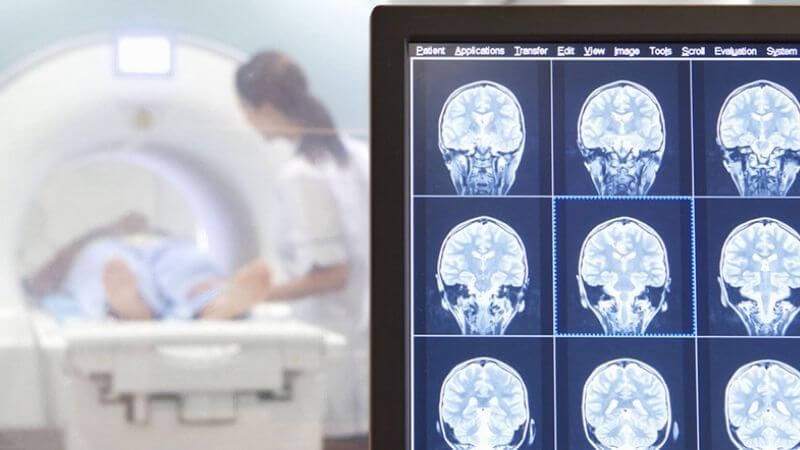 Chụp cắt lớp vi tính giúp chẩn đoán bệnh Chụp cộng hưởng từ sọ não giúp chẩn đoán bệnh