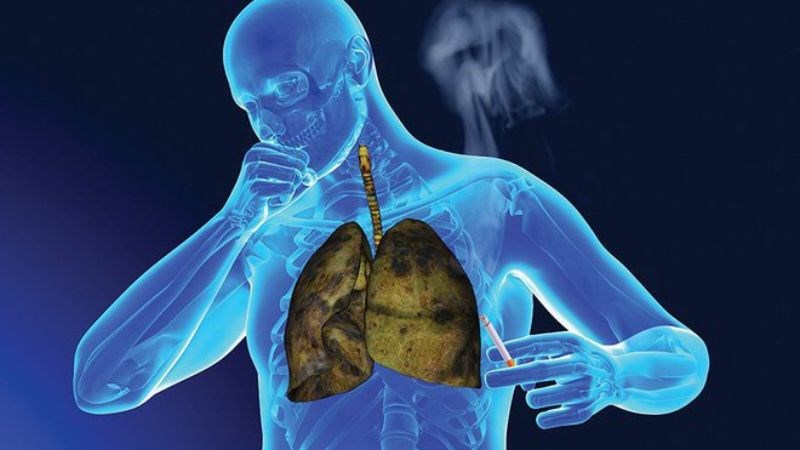 Ung thư phổi xuất phát từ tế bào đột biến, không gây lây nhiễm