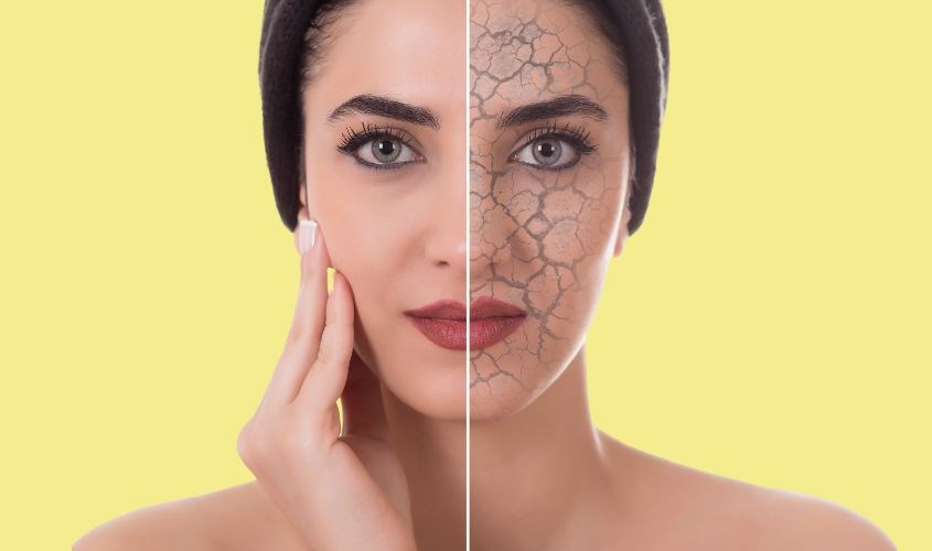 Dùng mỹ phẩm chứa urea giúp củng cố tế bào và làm dịu da