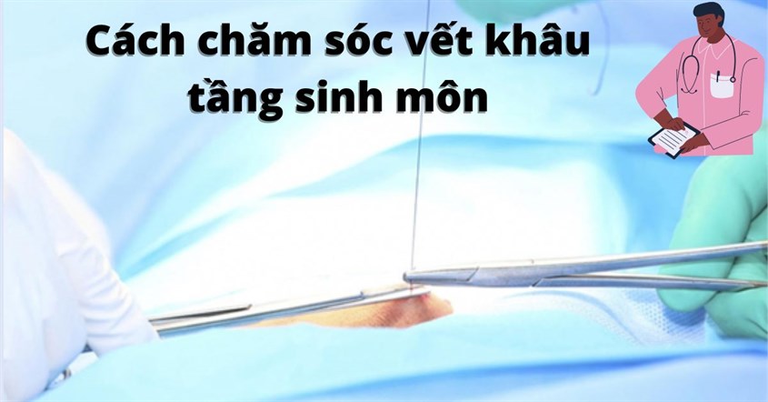 Chăm sóc vết khâu tầng sinh môn cần đúng cách, cẩn thận