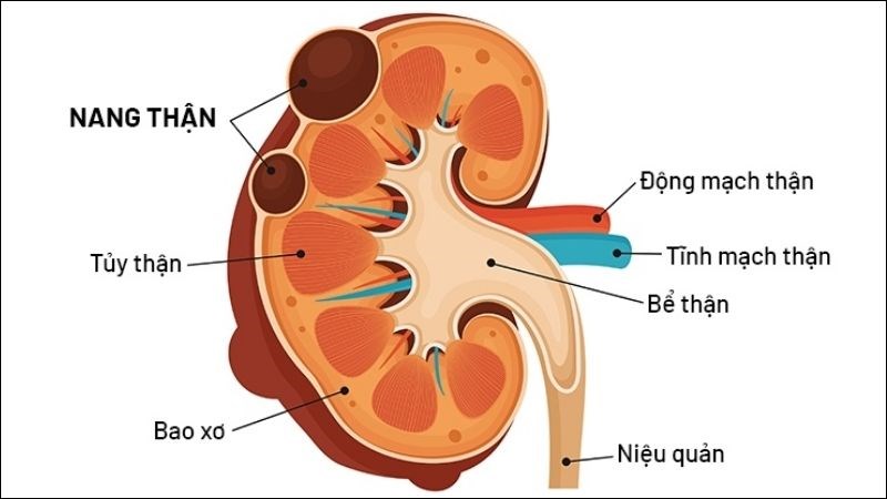 Thận là một cơ quan bài tiết phức tạp với nhiều bộ phận