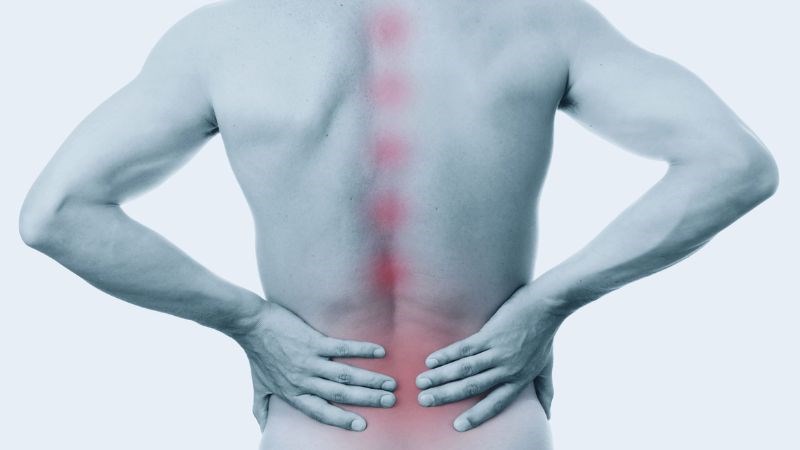 Viêm cột sống dính khớp là một loại viêm khớp, về lâu dài, có thể khiến các đốt sống dính lại với nhau