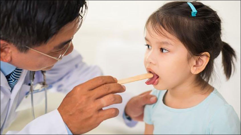 Viêm họng hạt ở trẻ em