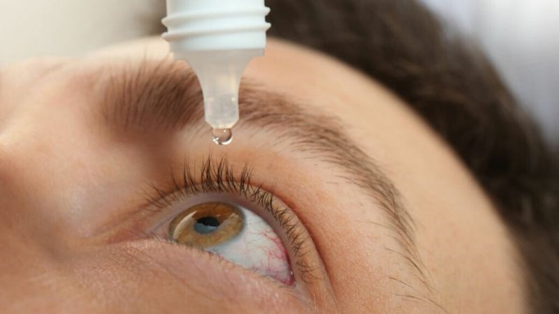Thuốc nhỏ mắt theo toa chứa corticoid là phương pháp điều trị phổ biến nhất Thuốc nhỏ mắt theo toa chứa corticoid là phương pháp điều trị phổ biến nhất