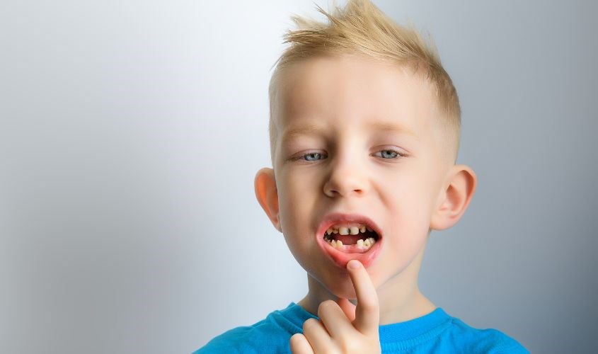 Xịt chống sâu răng Baby