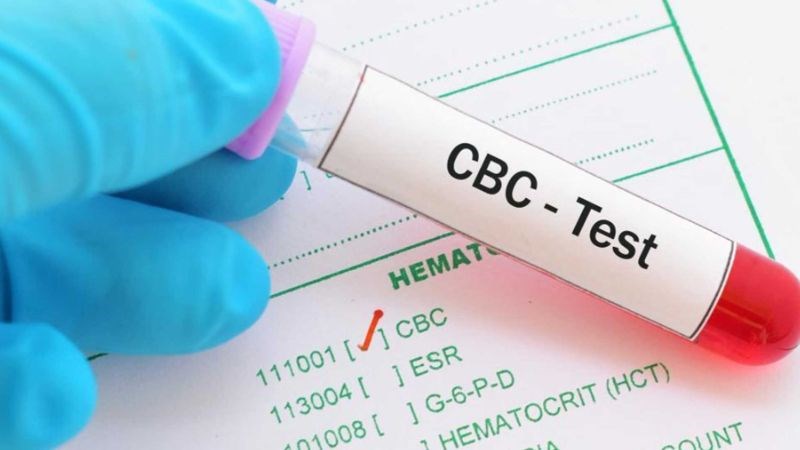 Xét nghiệm công thức máu (CBC) để chẩn đoán thiếu máu