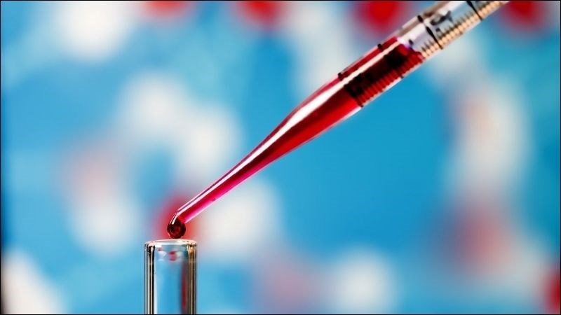 Xét nghiệm máu kiểm tra nồng độ cholesterol