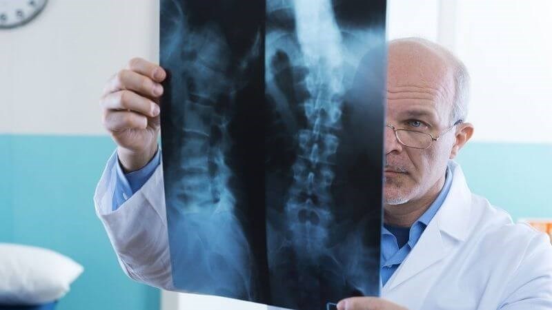 Chụp X-quang có thể giúp bác sĩ chẩn đoán đau thần kinh tọa