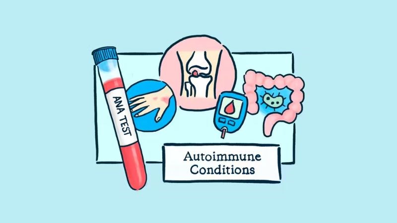Viêm tụy có thể xuất hiện do một số bệnh tự miễn