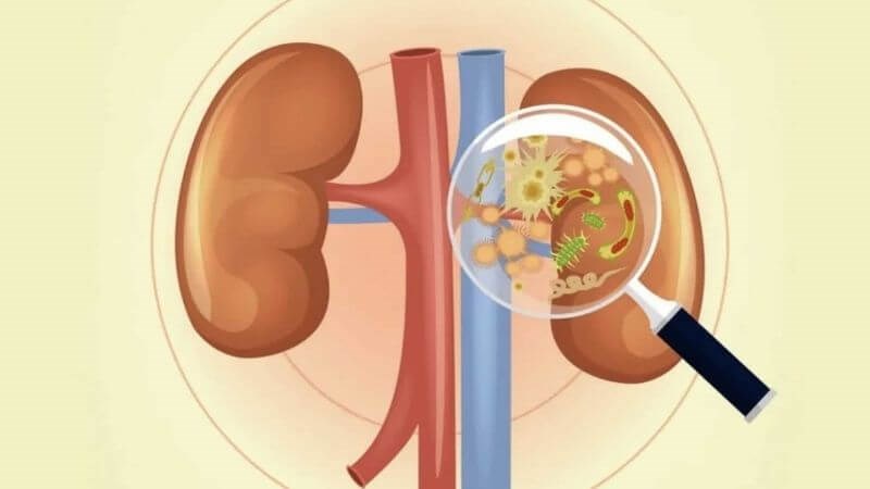 Ứ nước thận là một trong những biến chứng nguy hiểm Ứ nước thận là một trong những biến chứng nguy hiểm