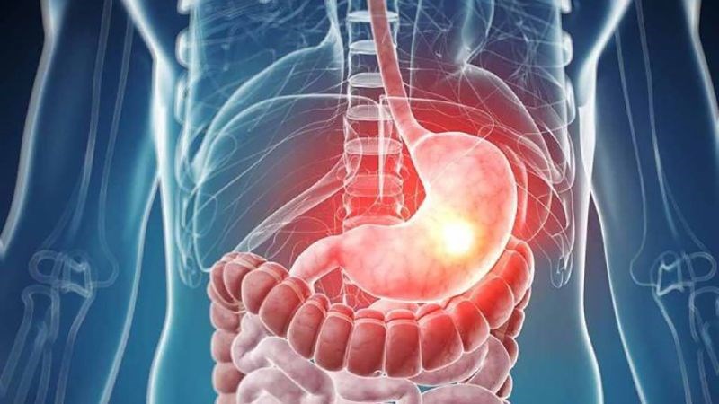Viêm dạ dày tá tràng có thể gây các biến chứng nguy hiểm