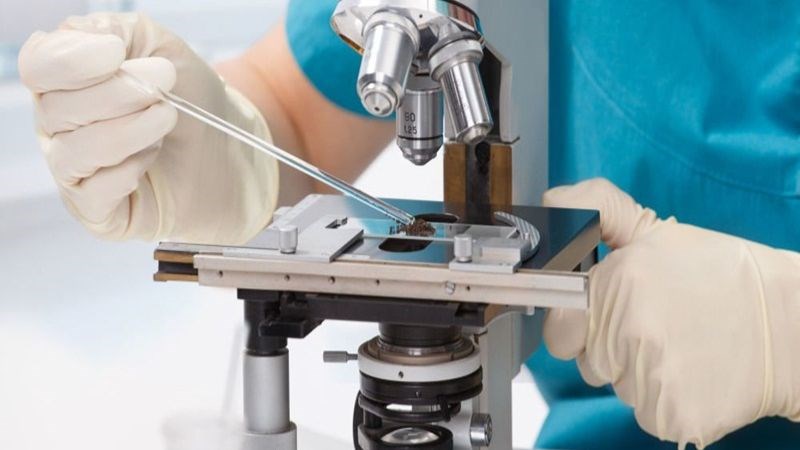 Xét nghiệm phân để chẩn đoán bệnh viêm dạ dày tá tràng