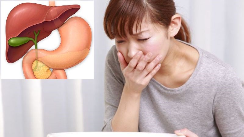 Trào ngược dịch mật gây viêm dạ dày tá tràng