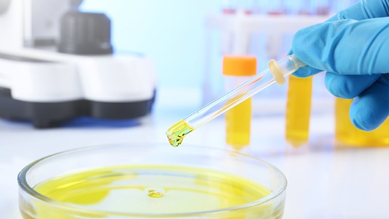 Phân tích nước tiểu giúp phát hiện các dấu hiệu bất thường như vi khuẩn, mủ trong nước tiểu