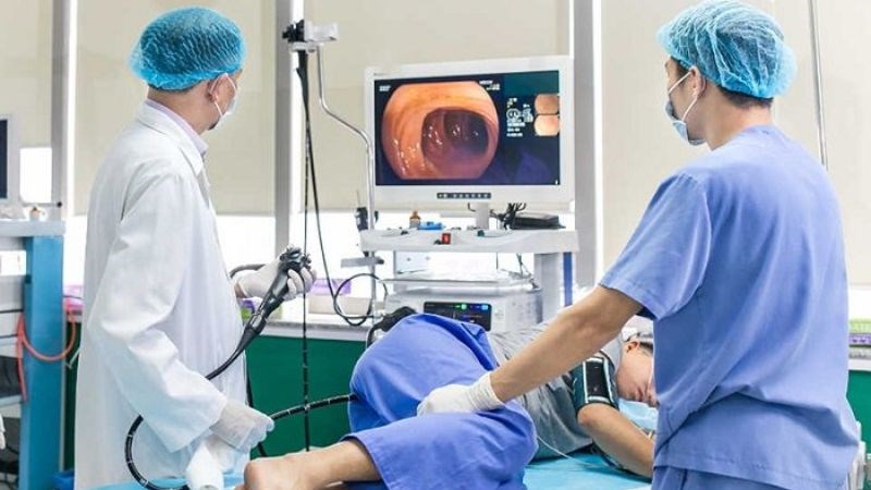 Nội soi đại tràng là một xét nghiệm bổ sung để chẩn đoán IBS Nội soi đại tràng là một xét nghiệm bổ sung để chẩn đoán IBS