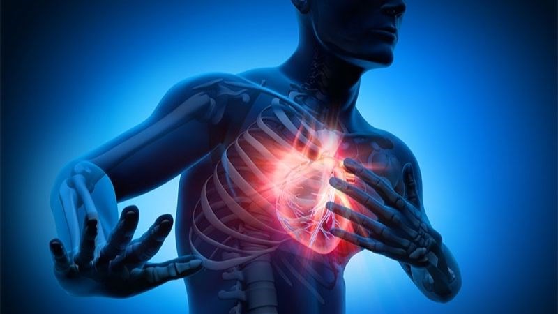 Đau ngực là triệu chứng điển hình của nhồi máu cơ tim 