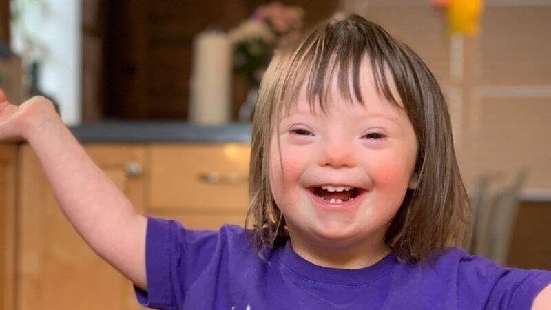 Trẻ mắc hội chứng Down có nhiều bất thường về thể chất và hành vi