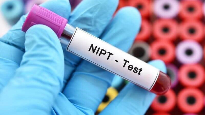 Xét nghiệm NIPT sẽ giúp chẩn đoán hội chứng Down trước sinh