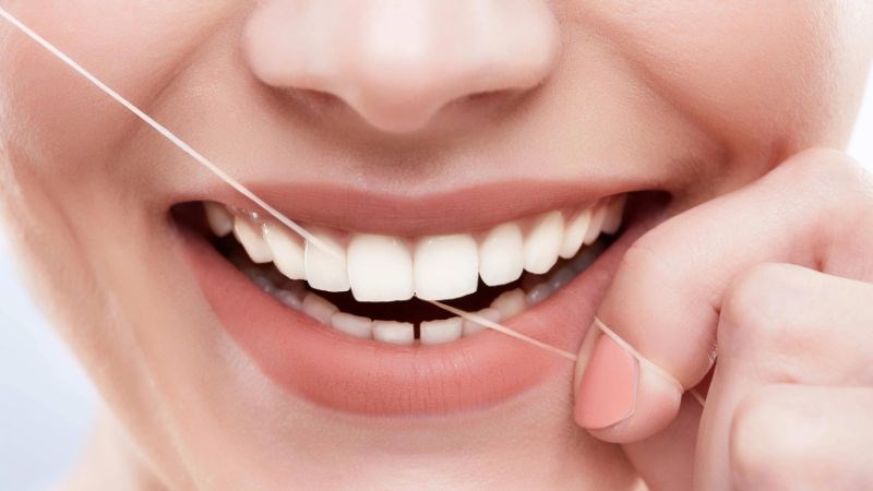 Dùng chỉ nha khoa có thể giúp cải thiện viêm nha chu