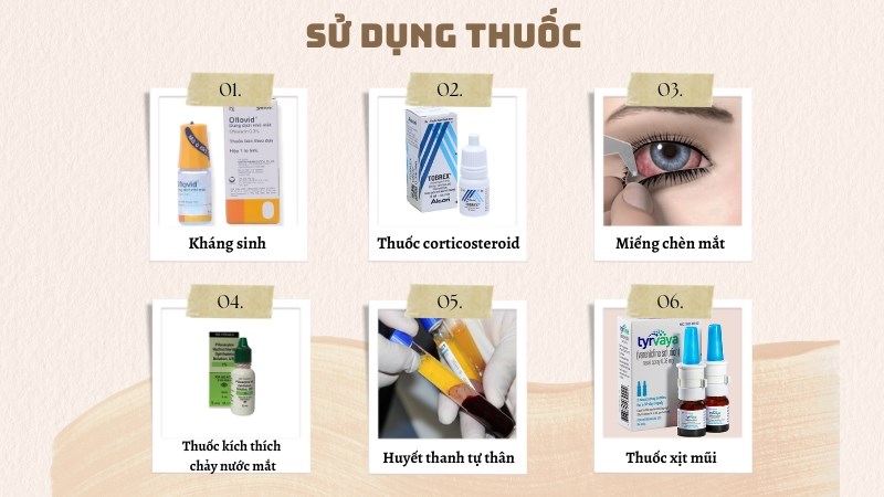 Sử dụng thuốc là phương pháp phổ biến trong điều trị khô mắt Sử dụng thuốc là phương pháp phổ biến trong điều trị khô mắt