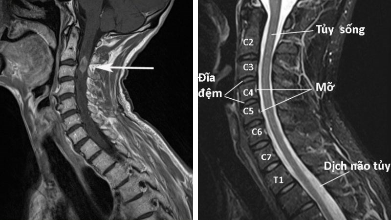 MRI giúp đánh giá hệ thống dây chằng, thần kinh và cơ MRI giúp đánh giá hệ thống dây chằng, thần kinh và cơ