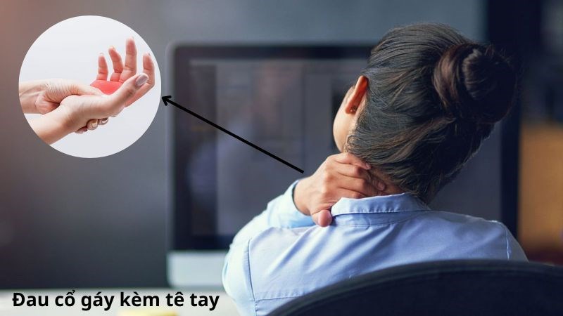 Đau cổ gáy kèm theo dấu hiệu tê tay nên đến gặp bác sĩ để được chẩn đoán Đau cổ gáy kèm theo dấu hiệu tê tay nên đến gặp bác sĩ để được chẩn đoán