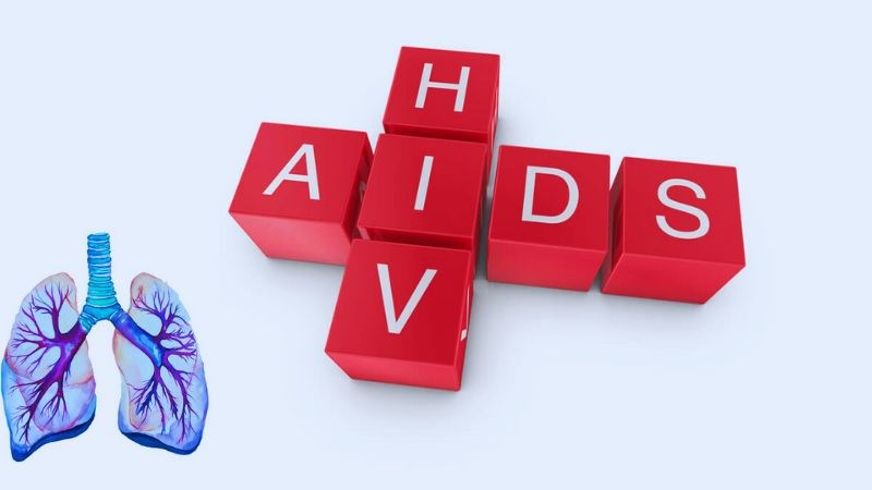 Người bị HIV thuộc nhóm đối tượng nguy cơ cao dễ mắc lao phổi
