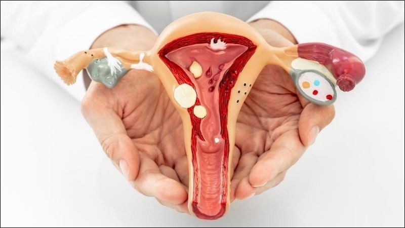 Polyp cổ tử cung: Nguyên nhân, dấu hiệu và các phương pháp điều trị