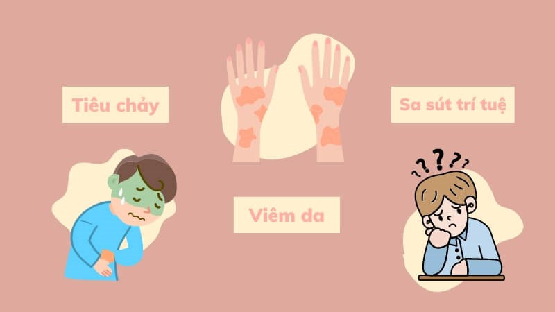 Ba biến chứng của bệnh Pellagra Bệnh Pellagra là gì? Nguyên nhân, triệu chứng và cách điều trị