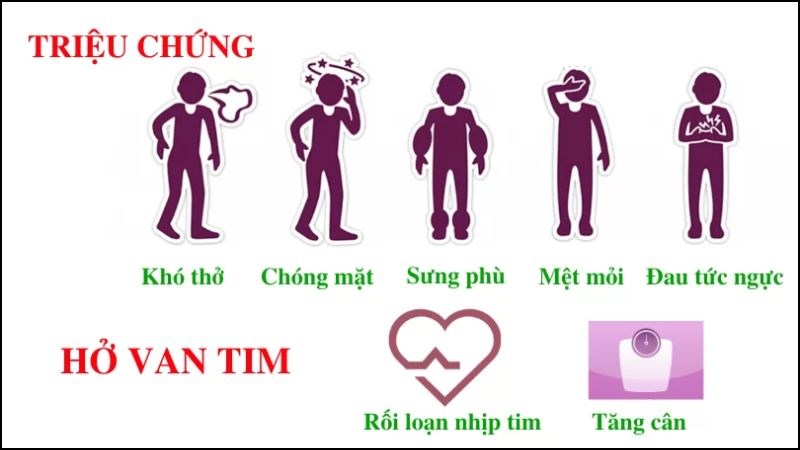 4. Biến chứng của bệnh hở van tim