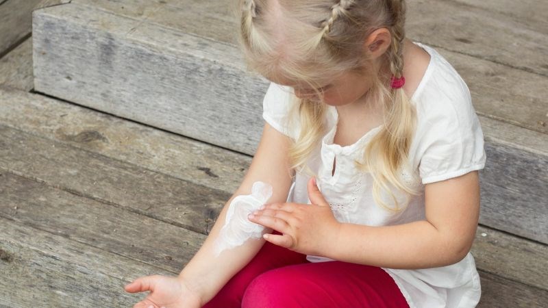 Bôi kem dưỡng ẩm giúp ngăn ngừa bệnh eczema