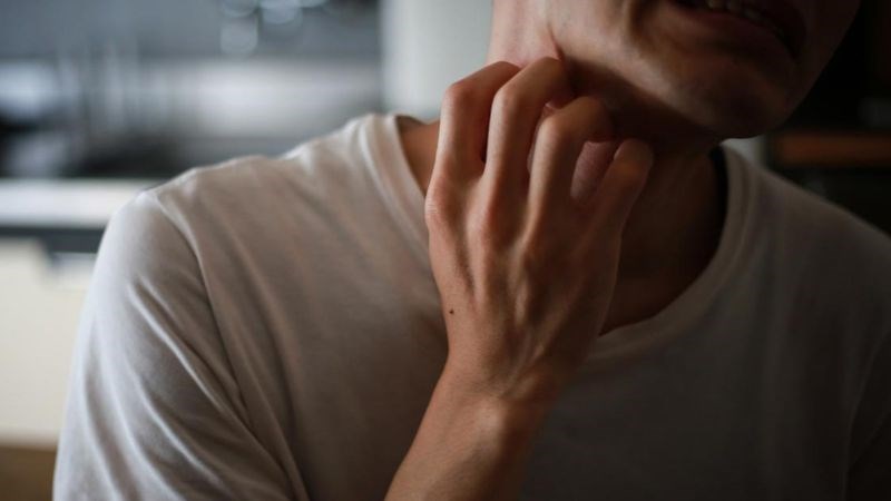 Các triệu chứng sưng đỏ, ngứa ngáy khó chịu có thể gây ảnh hưởng tới tinh thần và chất lượng cuộc sống