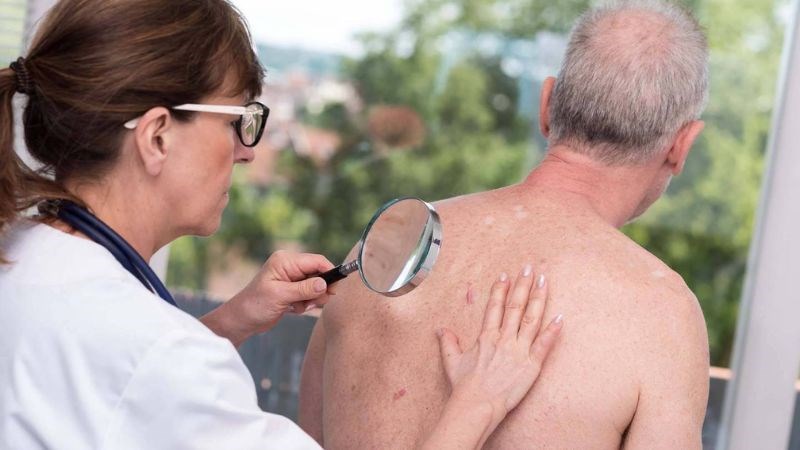 Bác sĩ sẽ kiểm tra da và hỏi về các triệu chứng mà bạn gặp phải