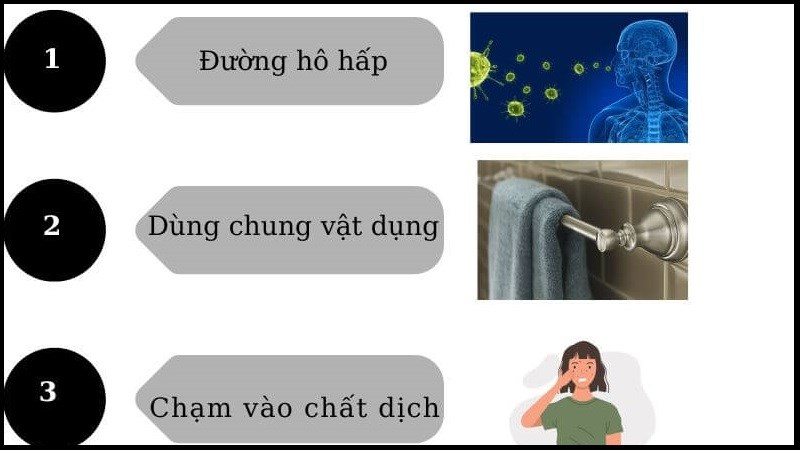 Các đường lây bệnh thuỷ đậu